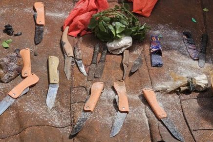 Wie ein Fachjournal weibliche Genitalverstümmelung verharmlost