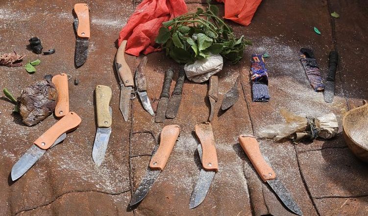 Wie ein Fachjournal weibliche Genitalverstümmelung verharmlost